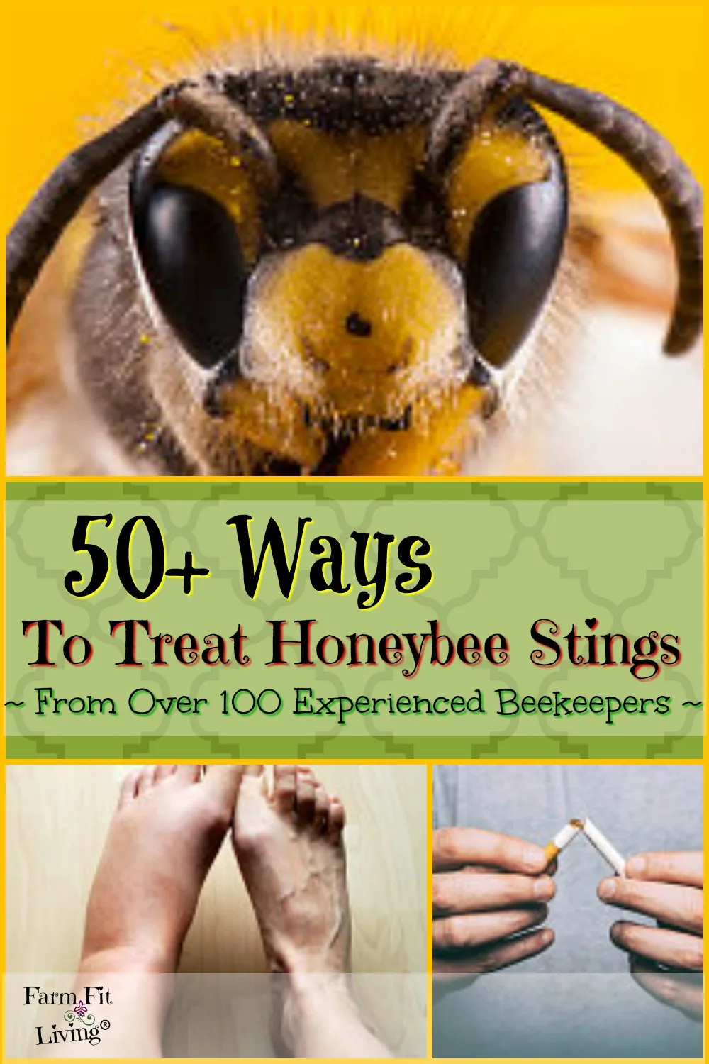 Causes And Treatments Of A Bee Sting