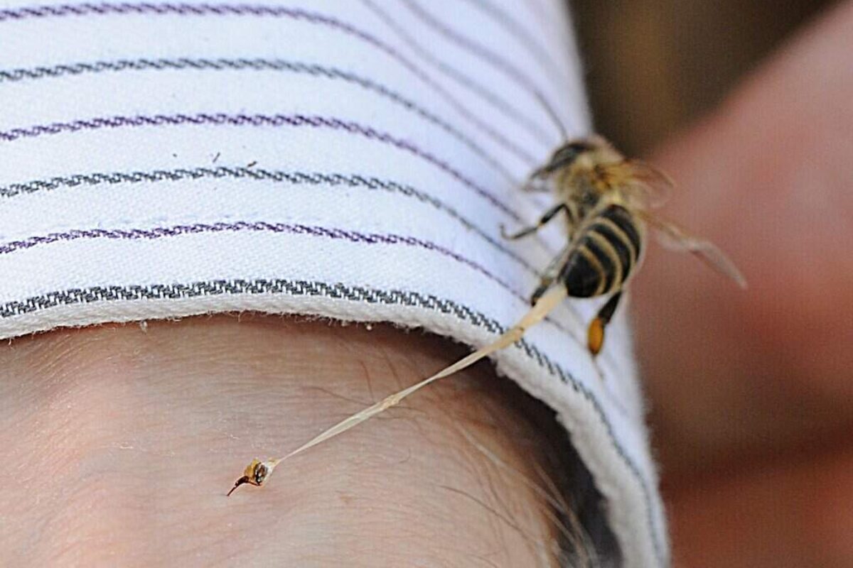 How a Photo of a Bee Sting Reveals the Secrets of Beekeeping