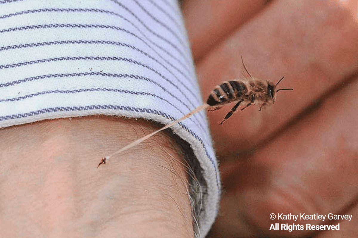 Treating A Queen Bee Sting